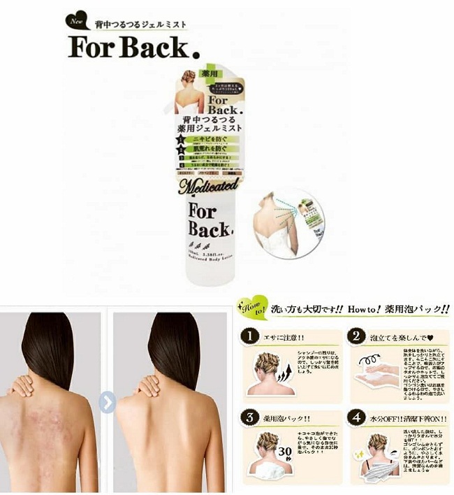 Gel hỗ trợ trị mụn lưng For Back dạng xịt Pelican Nhật Bản